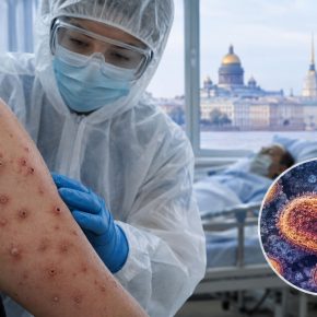 Оспа обезьян уже в Петербурге: диагноз заболевших подтвердился